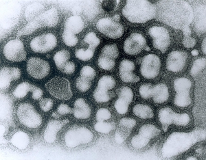 virus ptačí chřipky (HPAIV) pod elektronovým mikroskopem